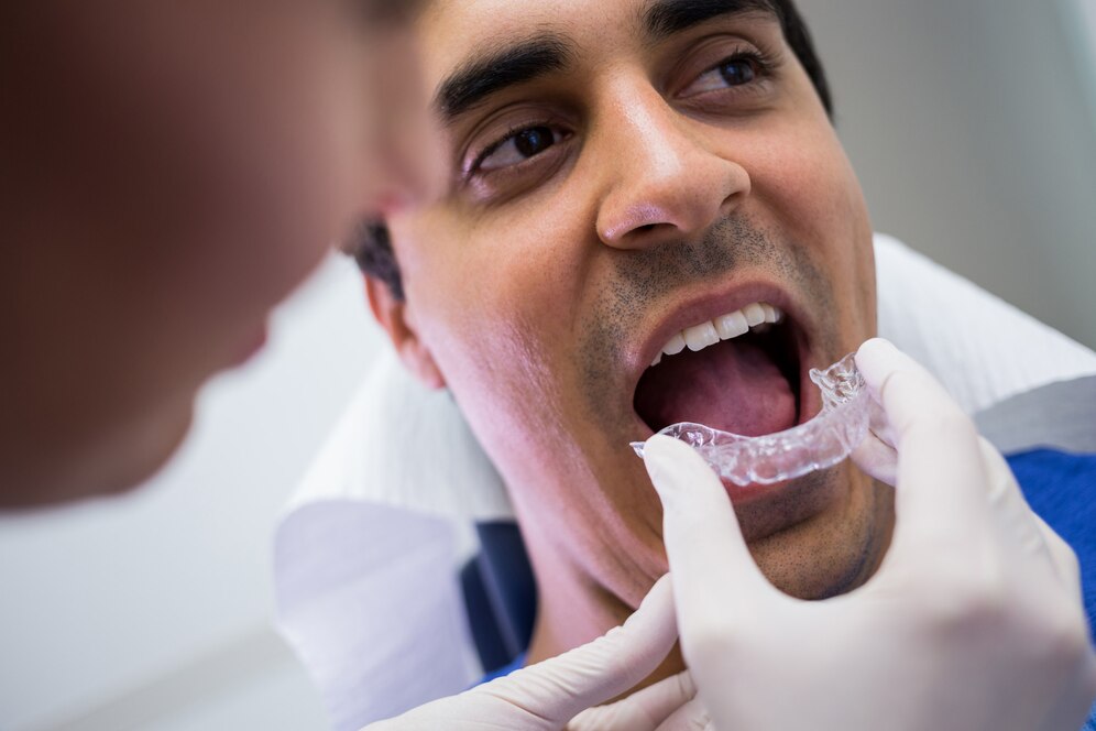 UNDERSTANDING THE PROCESS : STEP BY STEP INVISALIGN TREATMENT IN DELHI